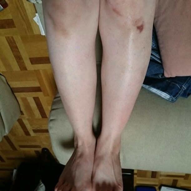 ボディ・フェイスケア no!no!Hair+