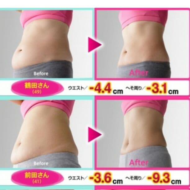 アセチノスマート