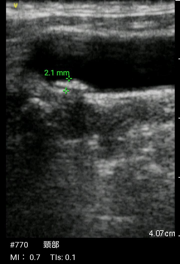 GE Vscan Extend 医療用モニタリング機器