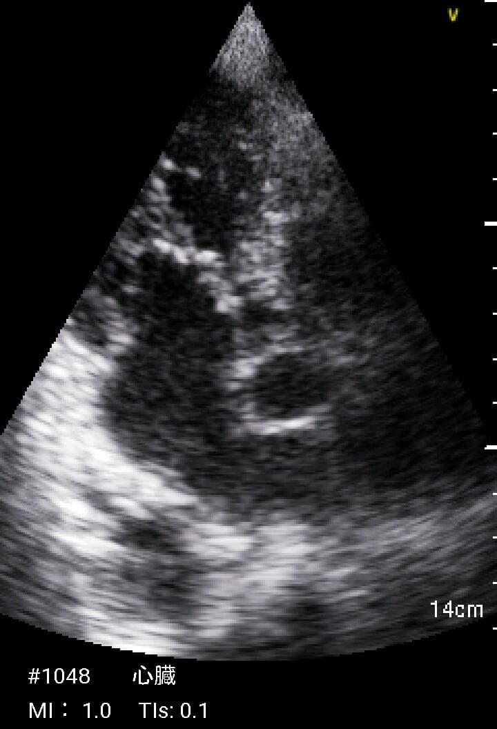 GE Vscan Extend 医療用モニタリング機器