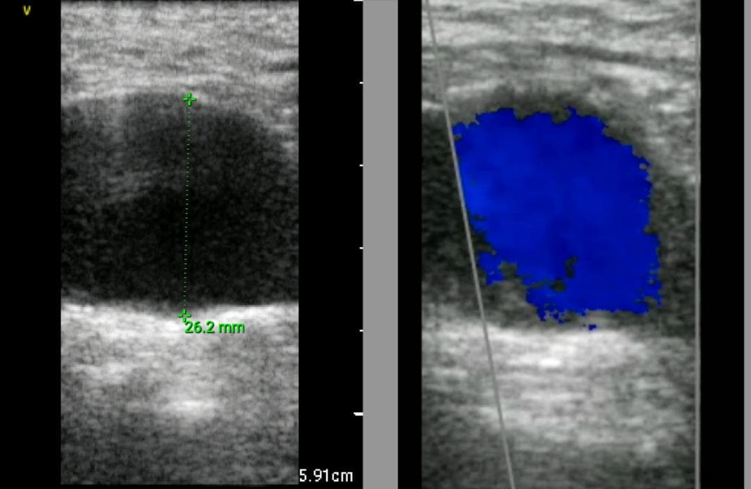GE Vscan Extend 医療用モニタリング機器