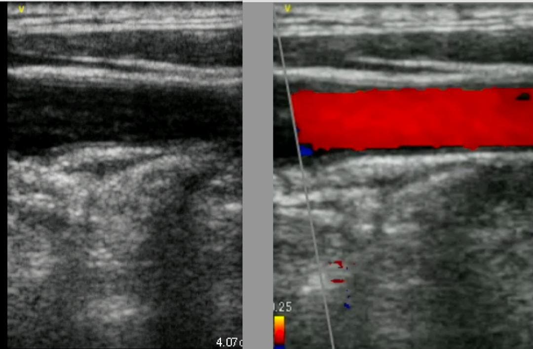 GE Vscan Extend 医療用モニタリング機器