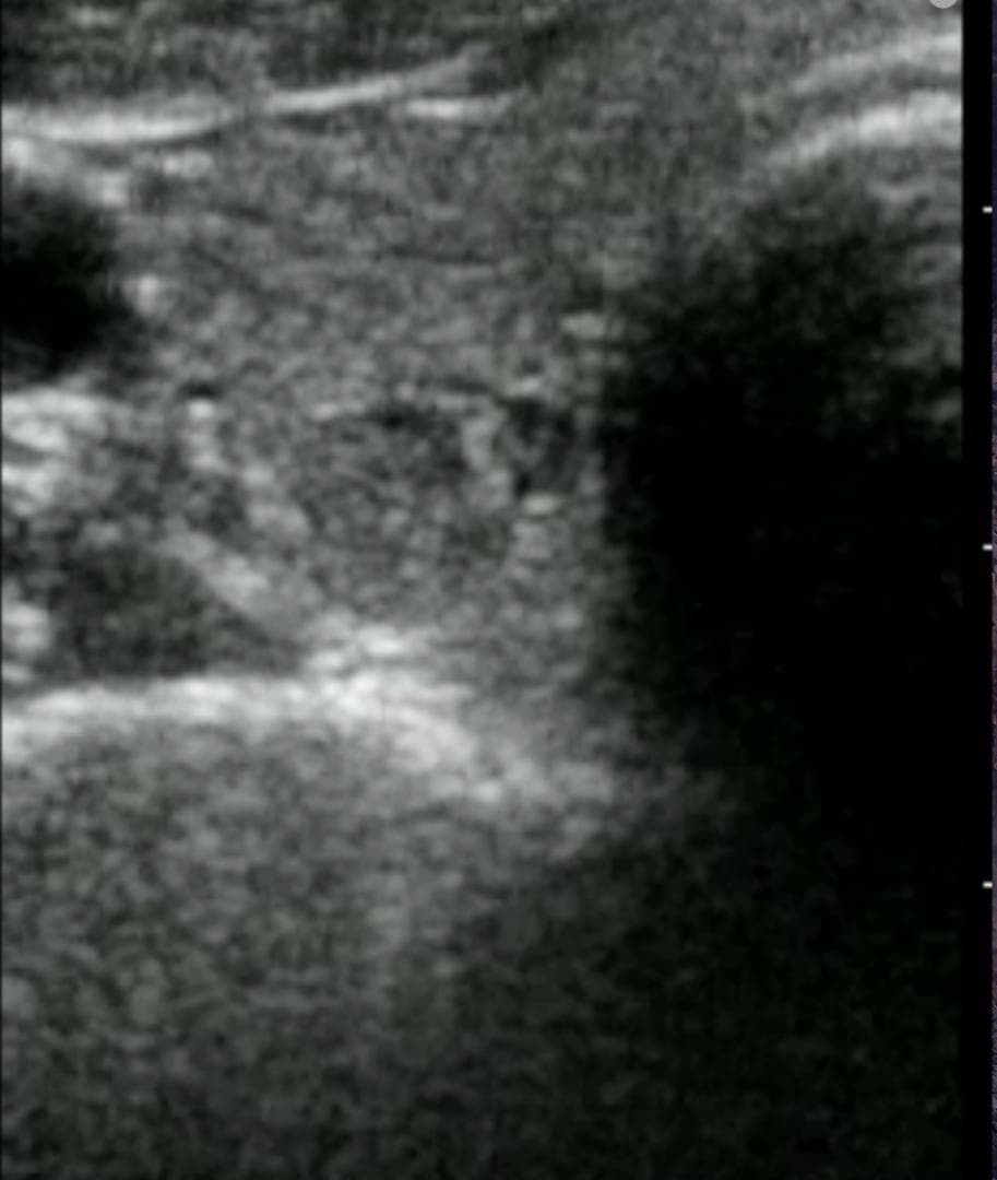 GE Vscan Extend 医療用モニタリング機器