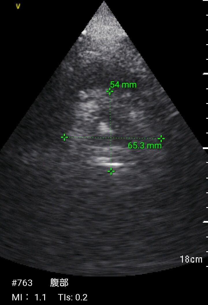 GE Vscan Extend 医療用モニタリング機器