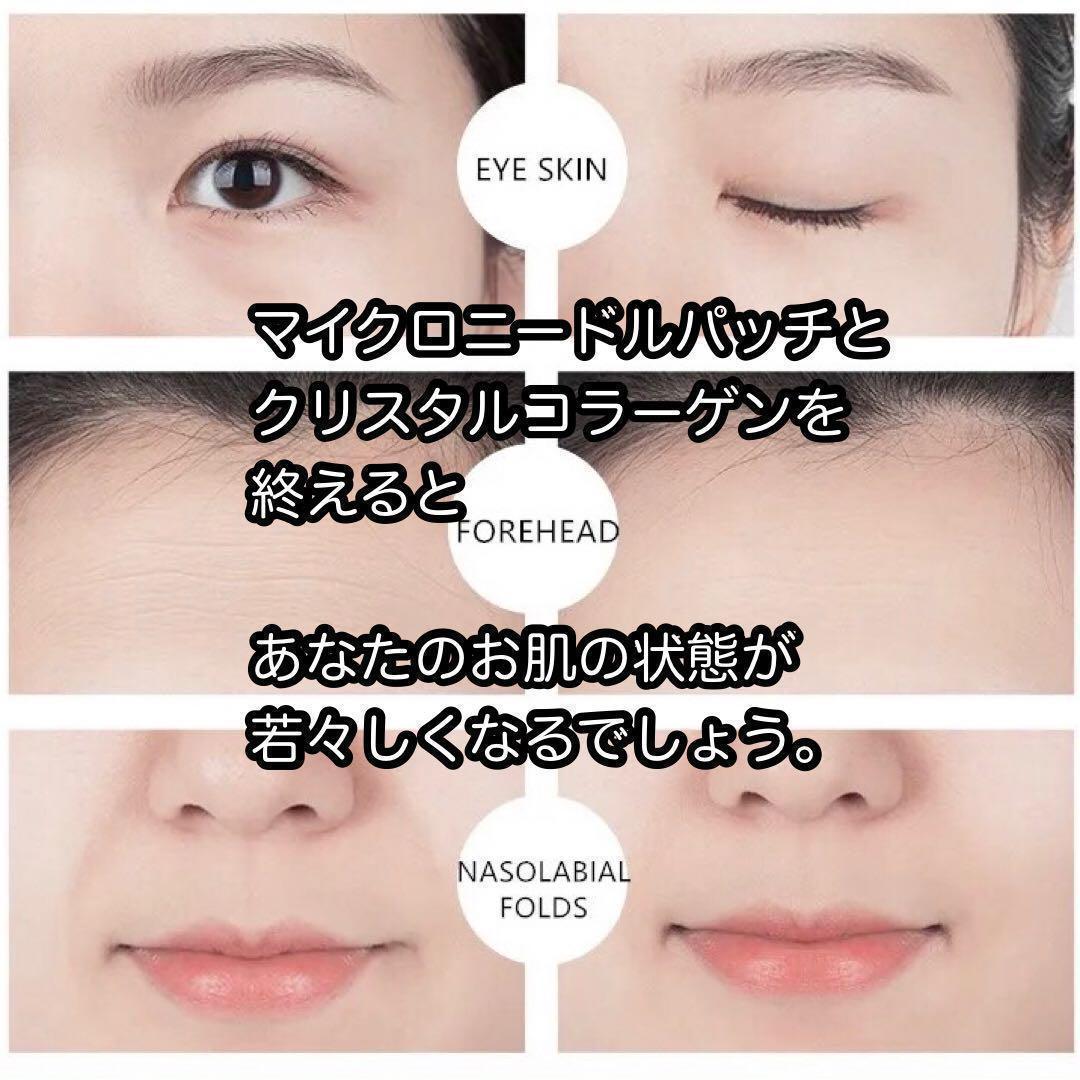 【2000針】マイクロニードルパッチ 100回分 針状美容液 ヒアルロン酸