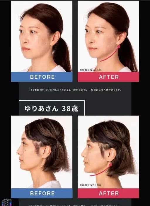 新品 リフトアップ 佐々木希Elekirush 美顔器 ハンドヘルド型