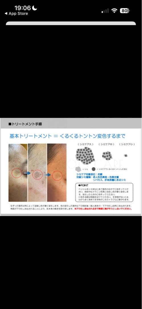 【未使用　新品】低周波シミ取り　未使用　ペンシルタイプ　業務用