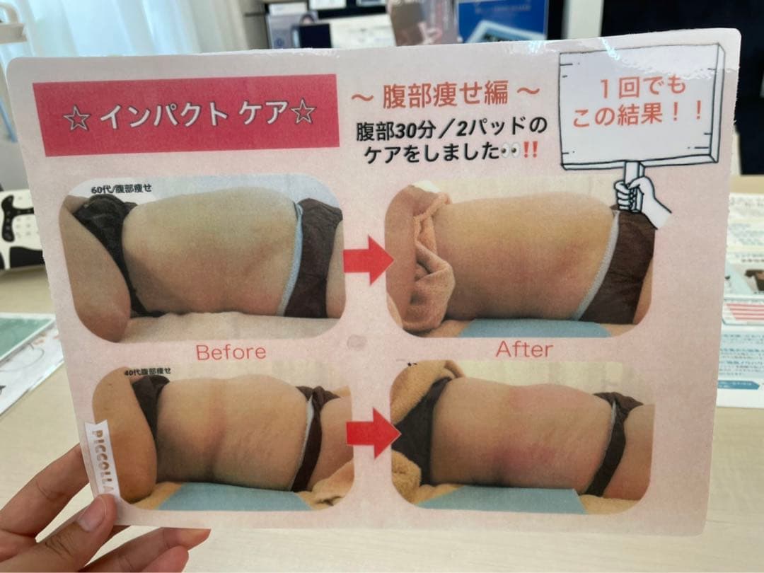 ボディ・フェイシャル 痩身 エステ機器　業務