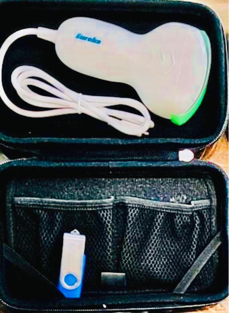 超音波検査装置（エコーゼリー無し）