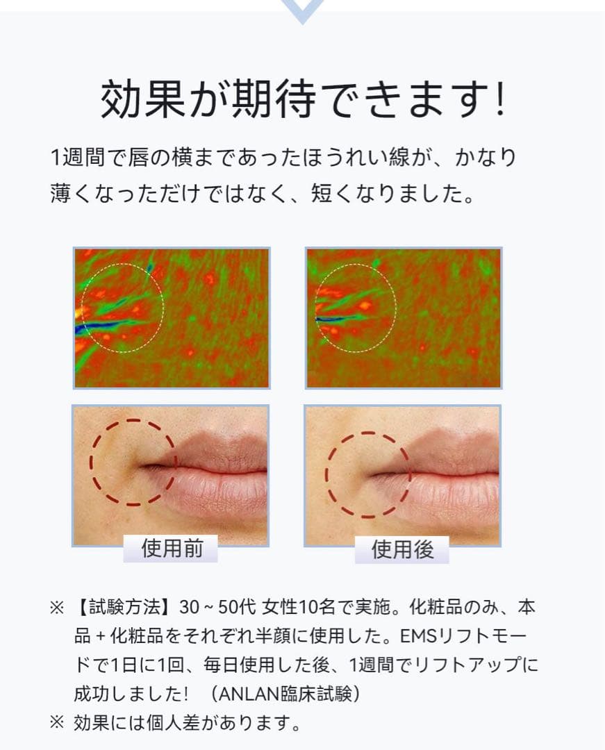 ANLAN 温冷美顔器PRO