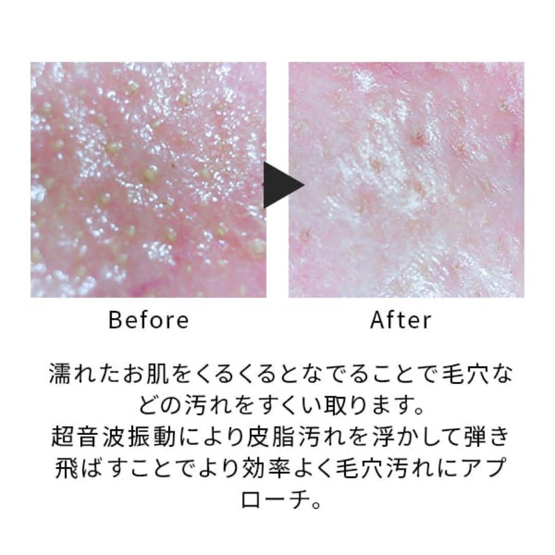 【新品未使用】ミーゼ ディープスキンクリア MS-43P【ヤーマン】