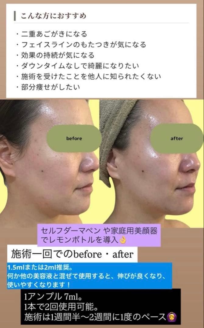 moka　レモンボトル×２本