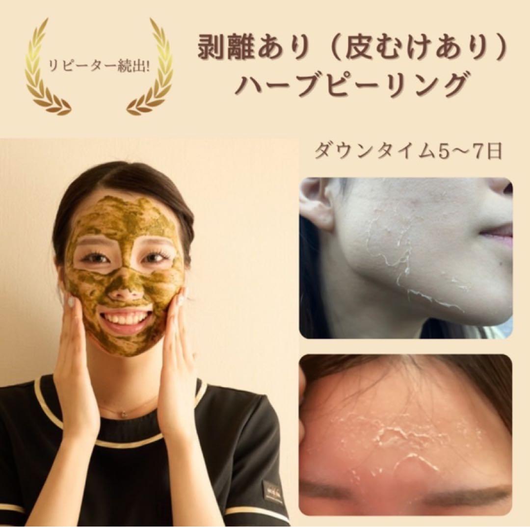 剥離ありハーブピーリング20回分