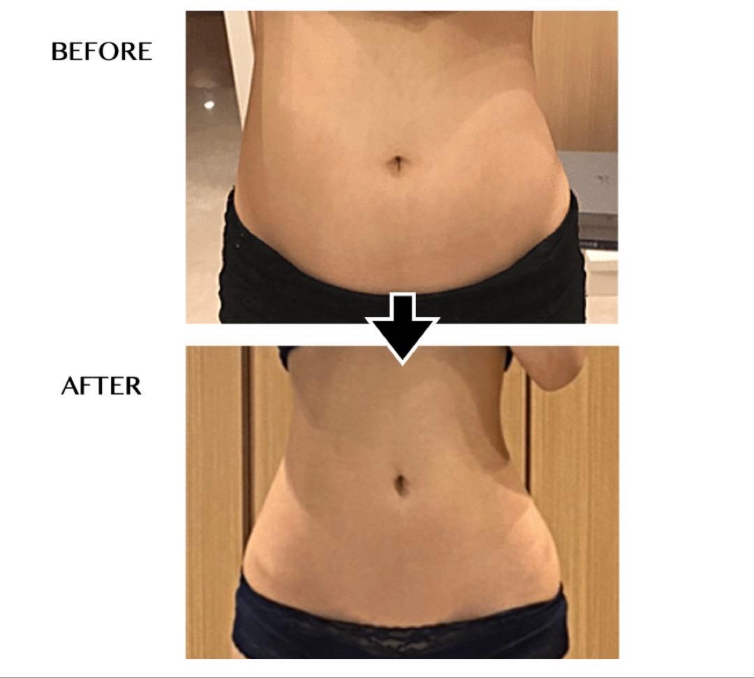 ✨＼キャンペーン／✨セルゼロバッグ 自分deエステ　痩身マシン ＲＦ